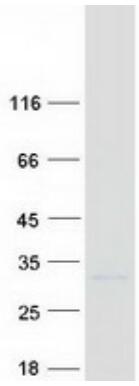 Coomassie blue staining of purified BCL2 protein.